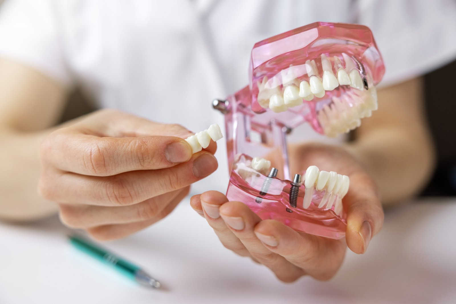 Prótese Dentária
